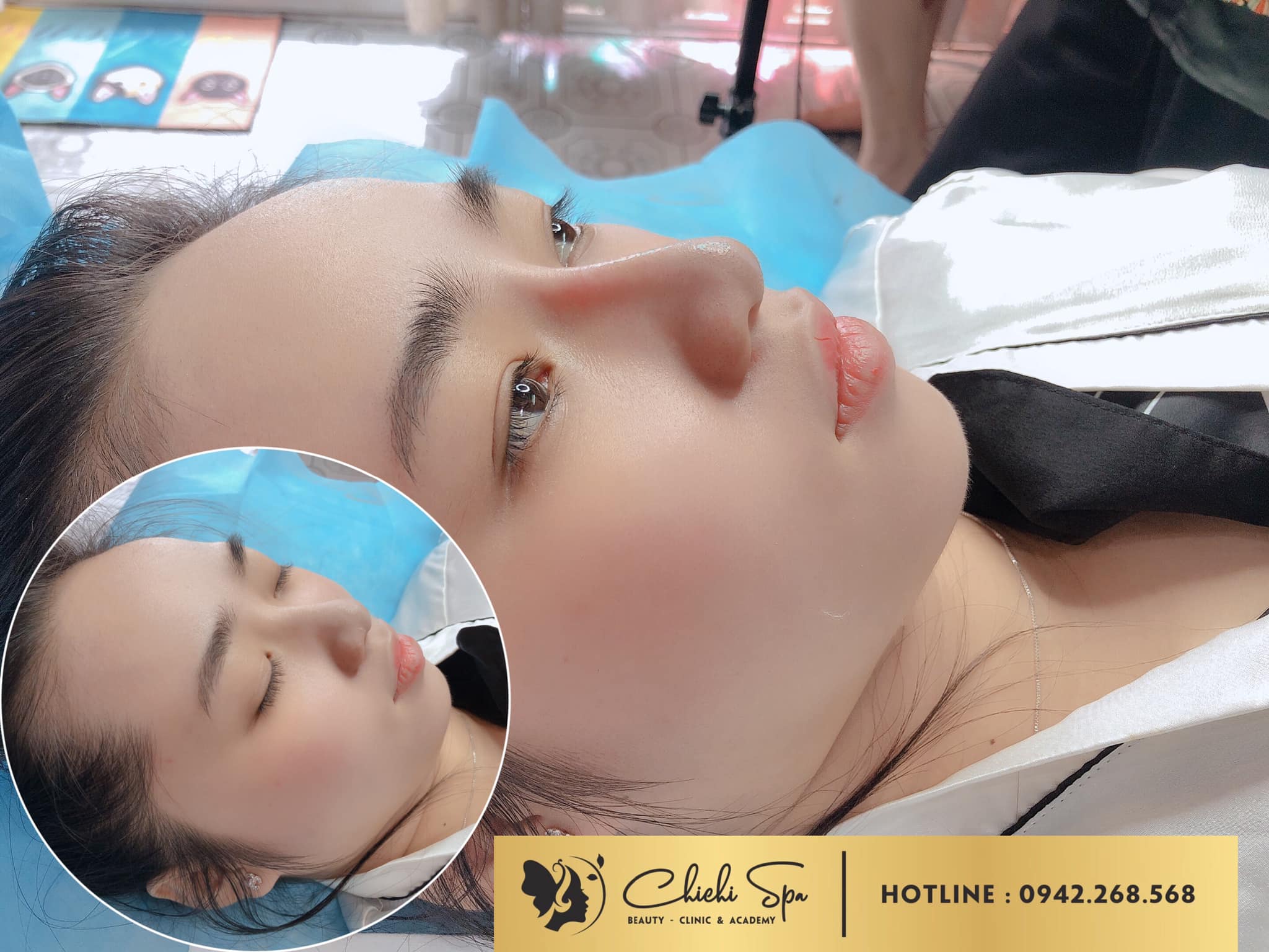 Chichi Spa ảnh 1