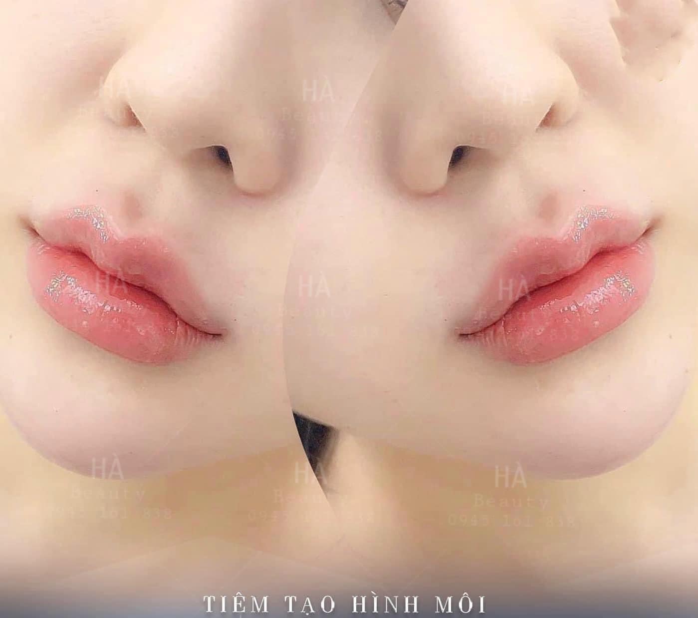 Hà Beauty & Spa ảnh 2