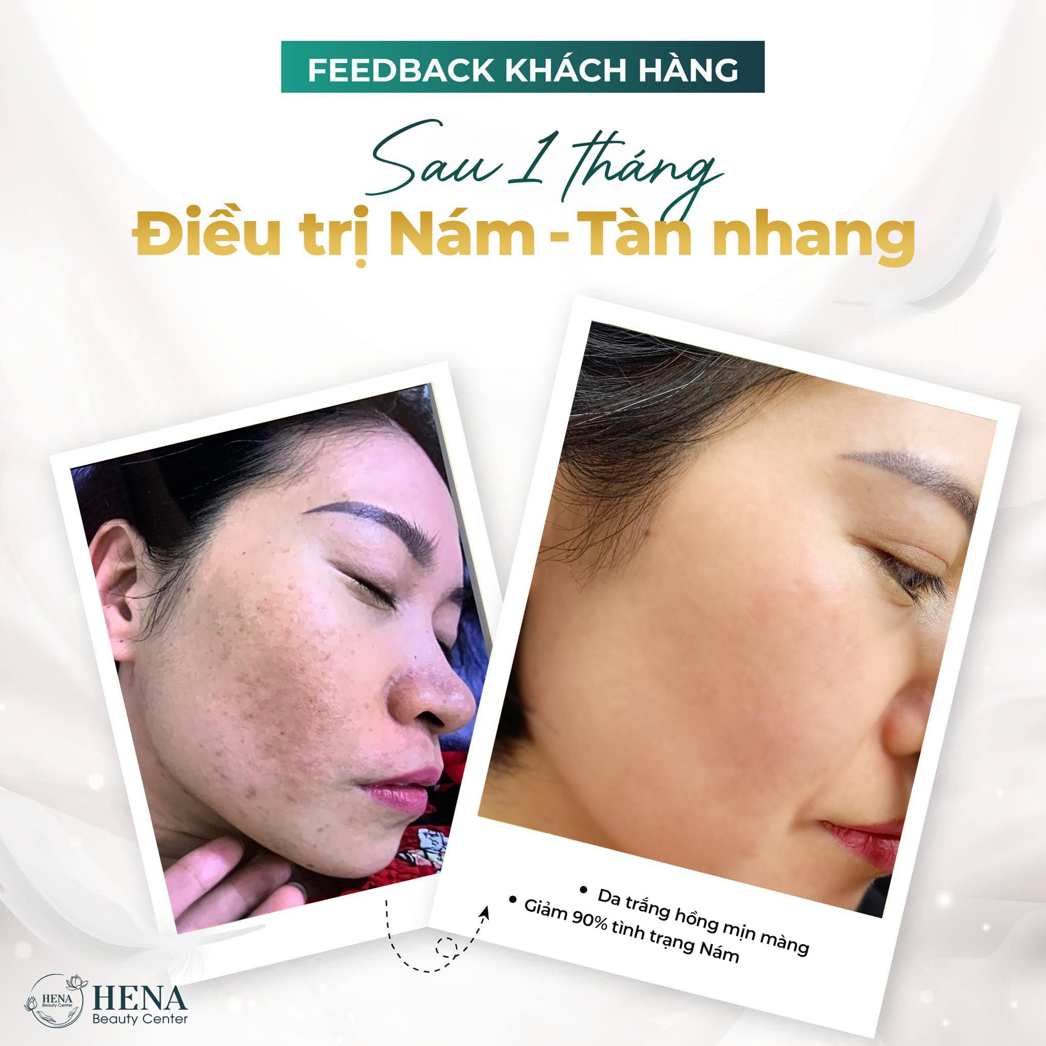 Hena Beauty Center ảnh 1