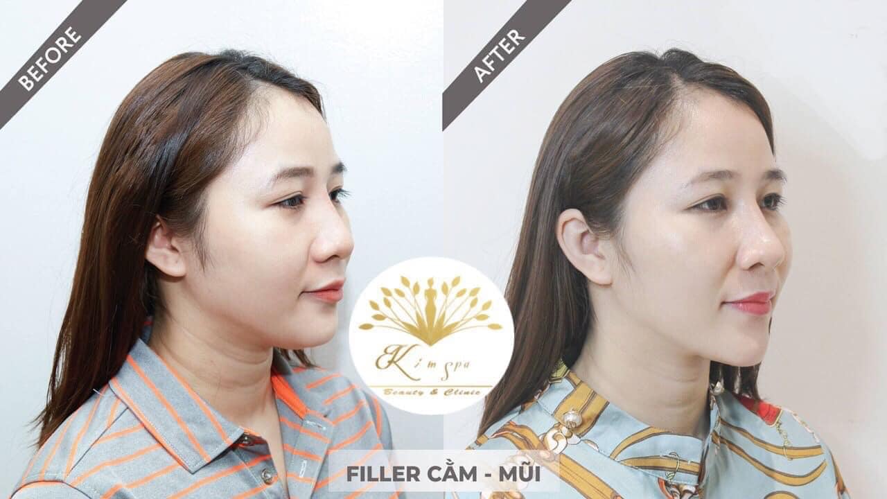 Kim Spa Tây Ninh ảnh 1