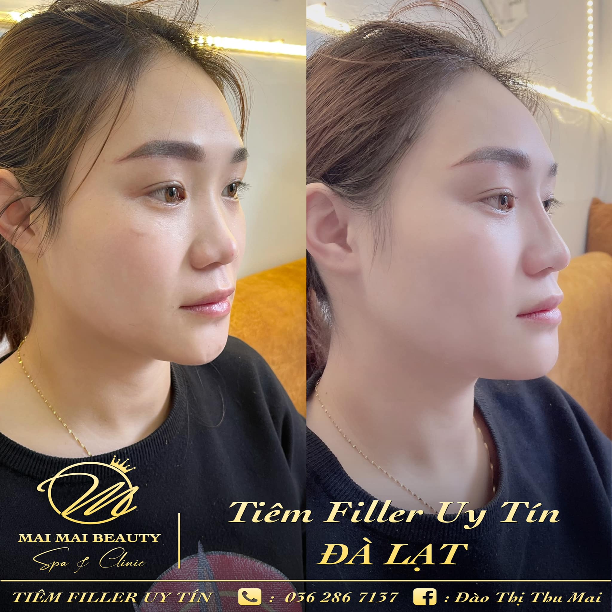 Mai Mai Beauty Spa & Clinic ảnh 1