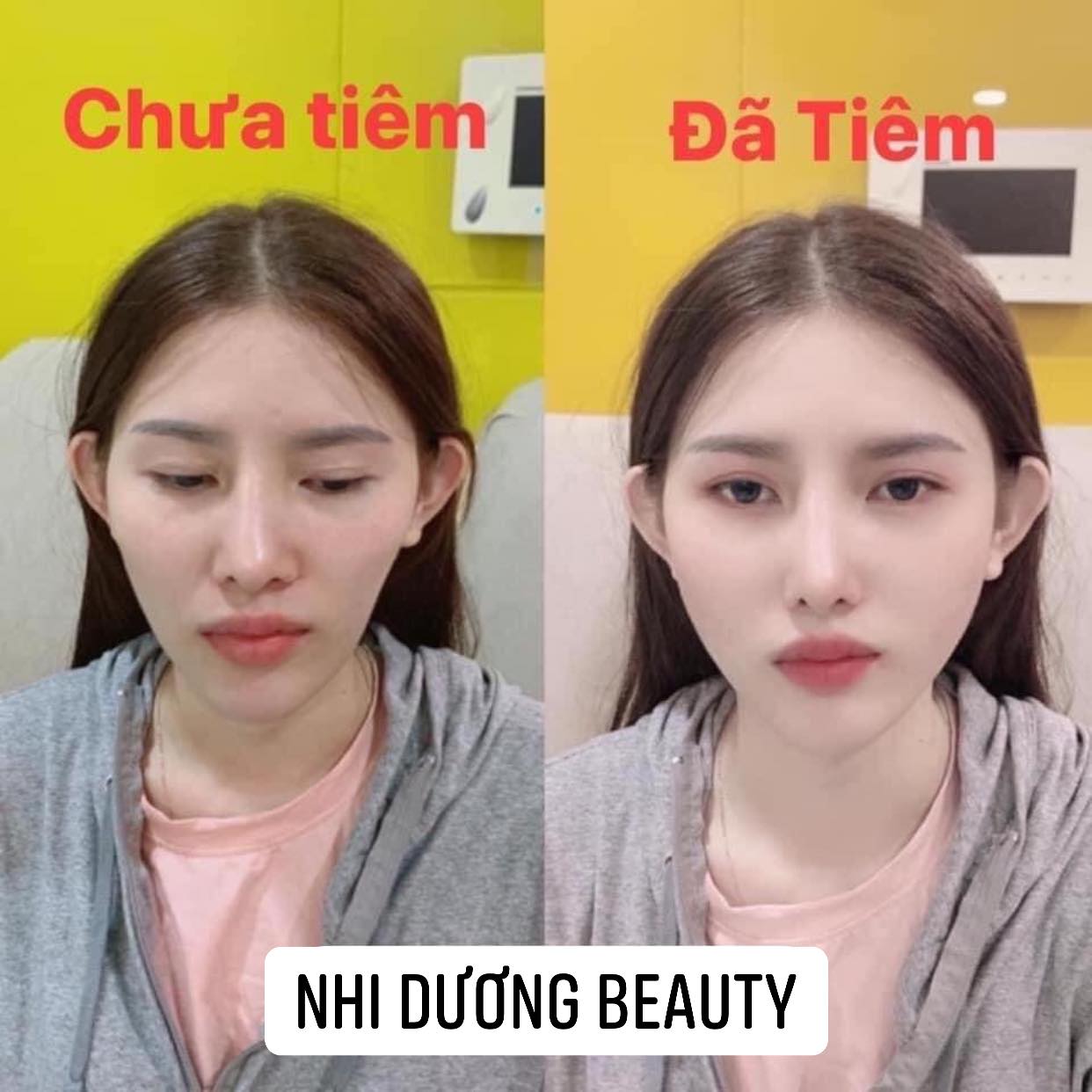 Nhi Dương Beauty ảnh 2