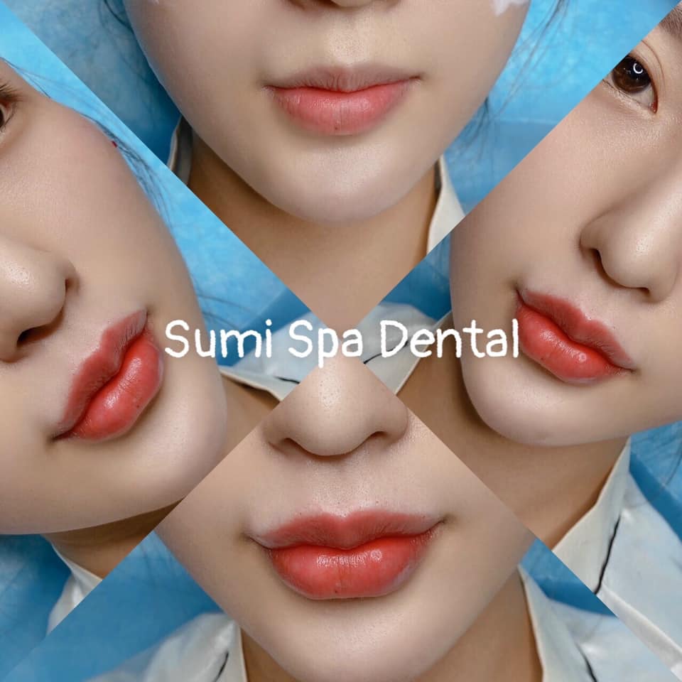 Spa Sumi ảnh 2