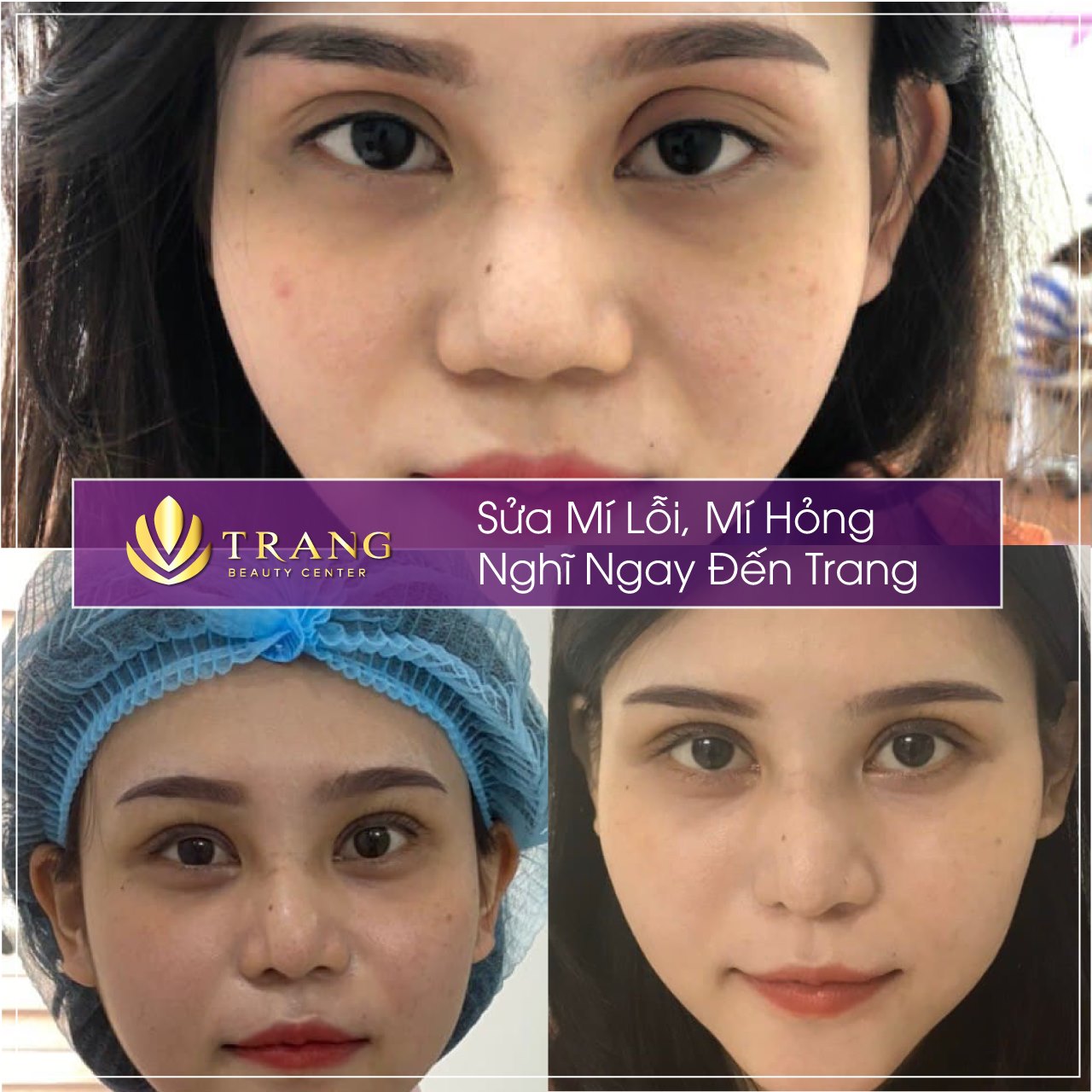 Trang Beauty Center ảnh 1