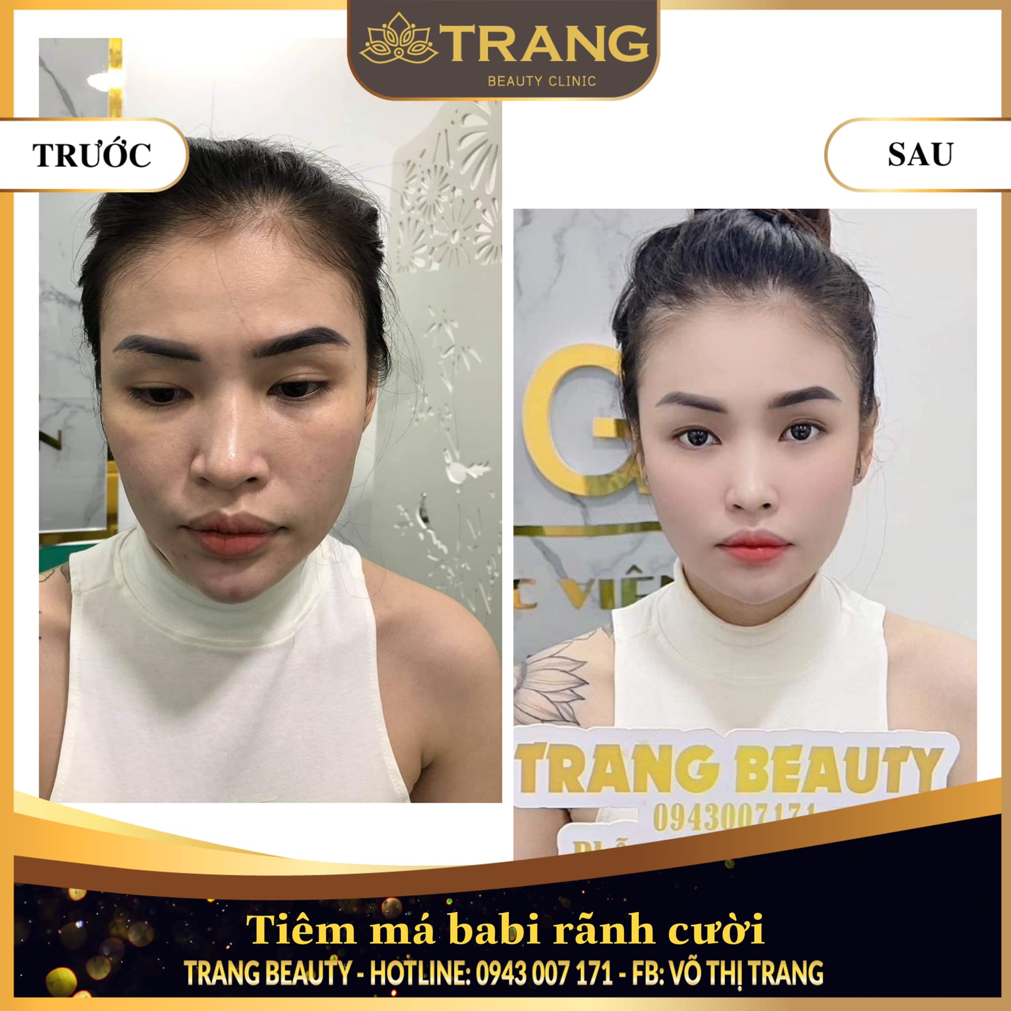 Trang Beauty Clinic ảnh 2