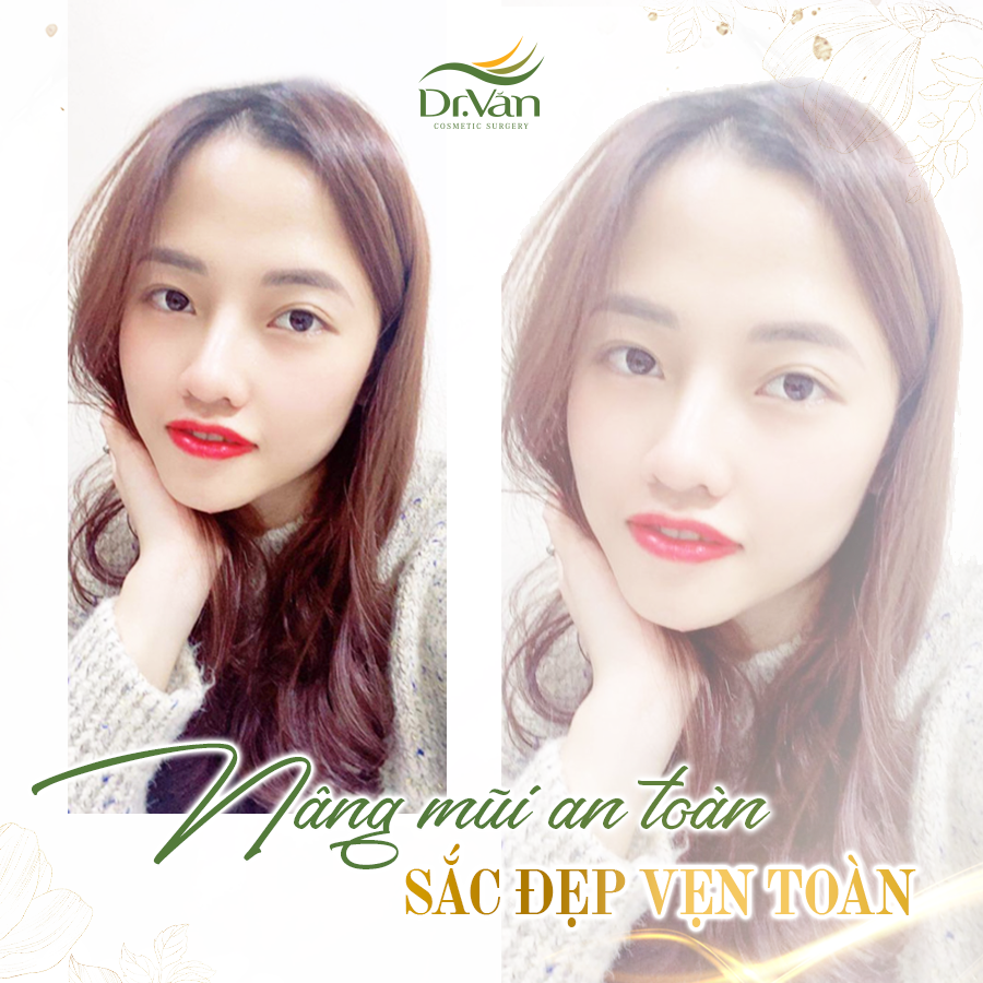 Viện Thẩm Mỹ Bác Sỹ Văn ảnh 2