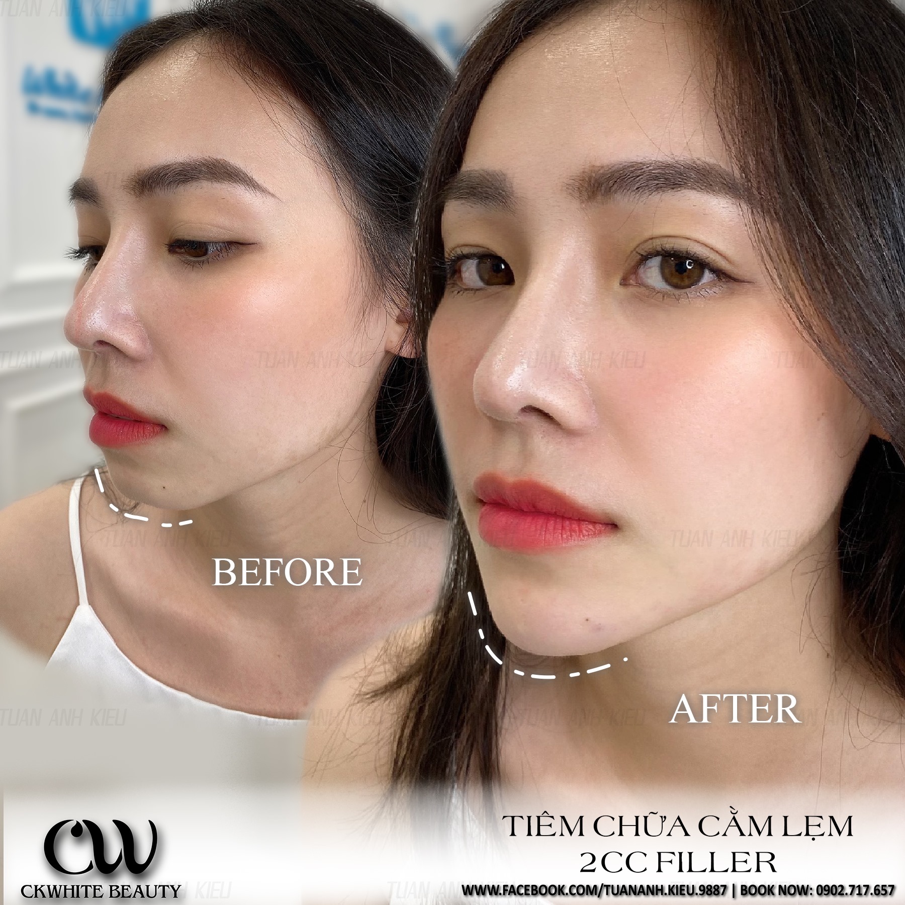 Viện Thẩm Mỹ CKWhite Beauty ảnh 2