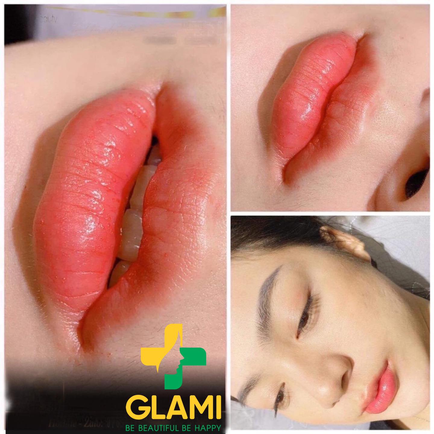 Viện Thẩm Mỹ GLAMI 198+ ảnh 1