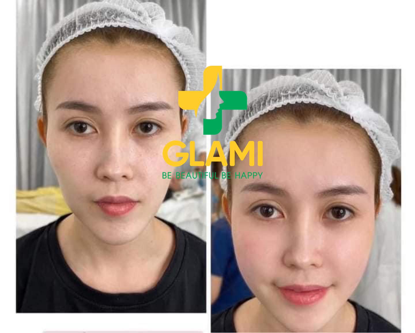 Viện Thẩm Mỹ GLAMI 198+ ảnh 2