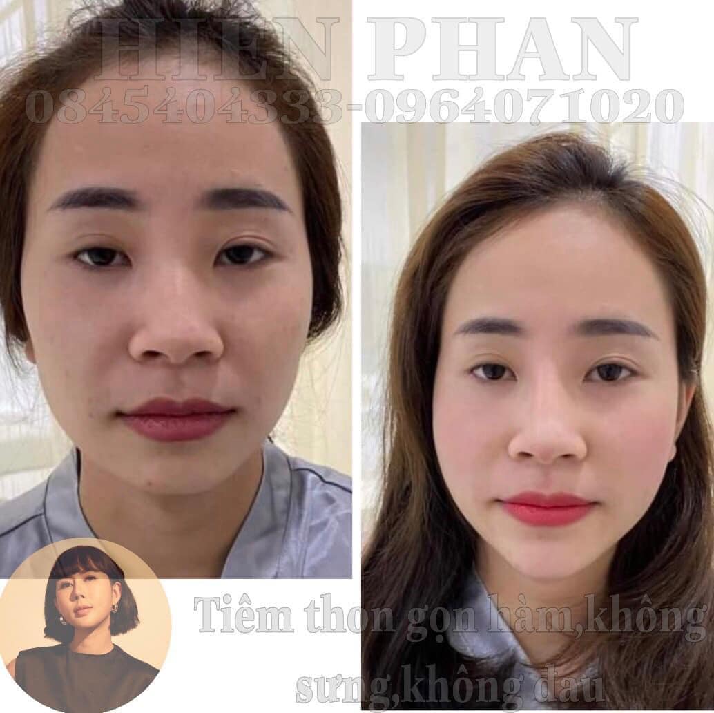 Viện Thẫm Mỹ Hiền Phan ảnh 2