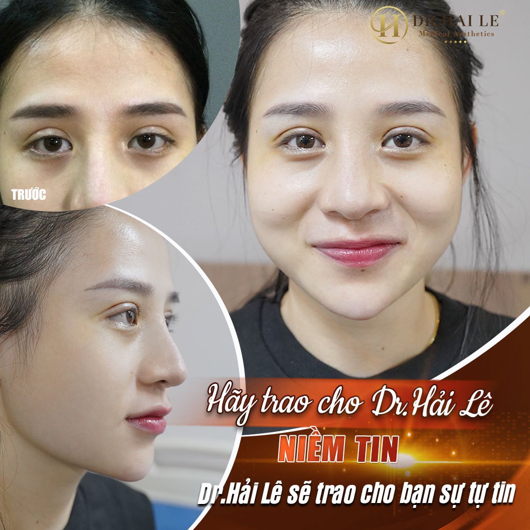 Viện Thẩm Mỹ Y Khoa Dr.Hải Lê ảnh 2