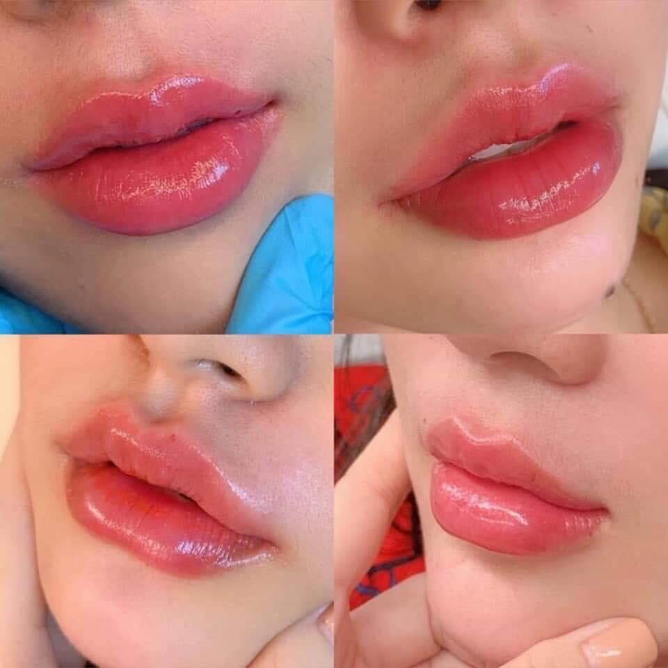 Cỏ spa ảnh 2