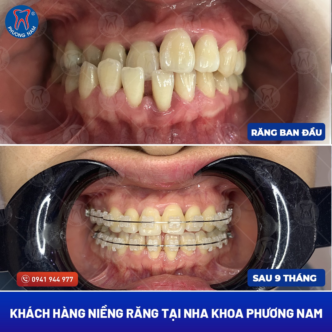 Nha khoa Phương Nam ảnh 1